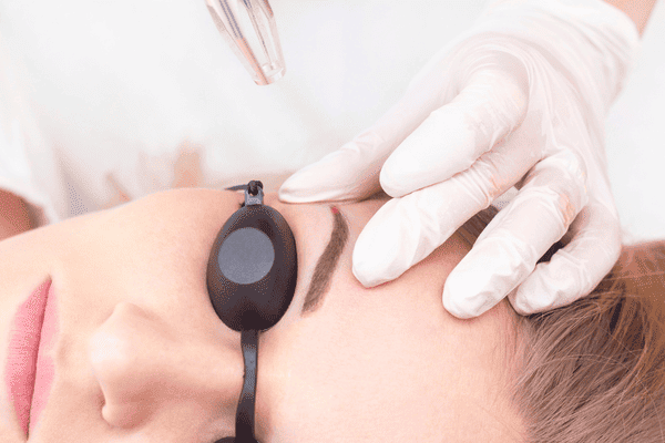 despigmentação-de-sobrancelhas-campo-limpo