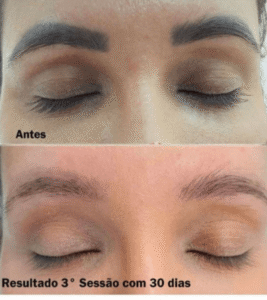 despigmentação-de-sobrancelhas-campo-limpo